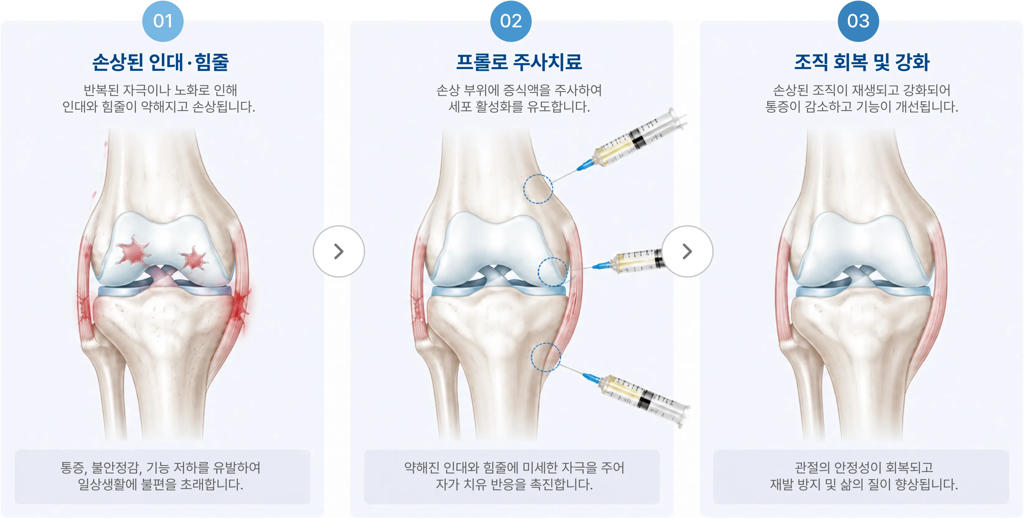 치료 방법 3단계: 01 손상된 인대·힘줄, 02 프롤로 주사치료, 03 조직 회복 및 강화